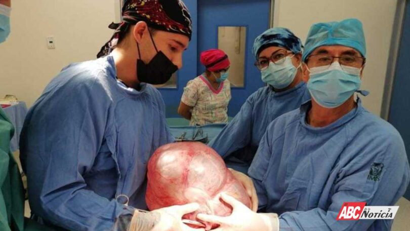 Retiran en IMSS-Bienestar de Tecuala tumor de 10 kilos a menor de 16 años
