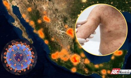 CON PRECAUCIÓN… Después de vejez viruela